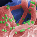 Sida : les réservoirs du VIH seraient bien plus nombreux que prévu